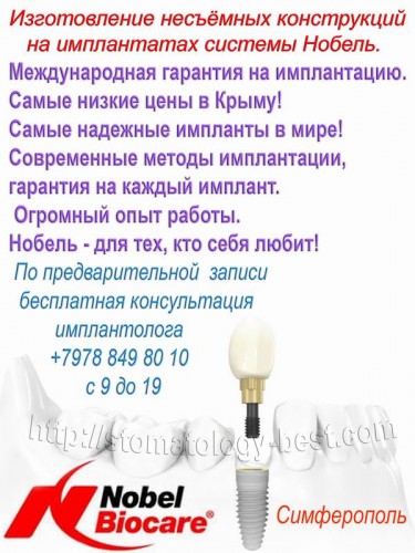 Изготовление несъёмных конструкций на имплантатах системы Нобель.